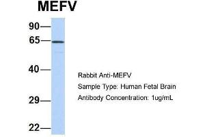 Host:  Rabbit  Target Name:  MEFV  Sample Type:  Human Fetal Brain  Antibody Dilution:  1. (MEFV anticorps  (N-Term))