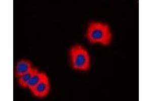 Immunofluorescent analysis of IRAK3 staining in LOVO cells. (IRAK3 anticorps  (C-Term))