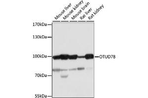 Western blot analysis of extracts of various cell lines, using OTUD7B antibody (ABIN7269125) at 1:1000 dilution. (OTUD7B anticorps  (AA 530-700))