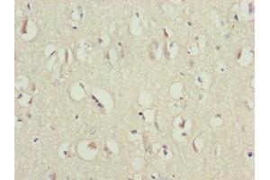 Immunohistochemistry of paraffin-embedded human brain tissue using ABIN7146448 at dilution of 1:100 (CAMK2D anticorps  (AA 1-260))