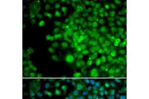 Immunofluorescence analysis of HeLa cells using FHL1 Polyclonal Antibody (FHL1 anticorps)