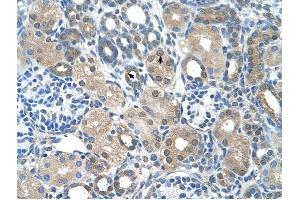 FBXO25 antibody was used for immunohistochemistry at a concentration of 4-8 ug/ml to stain Epithelial cells of renal tubule (arrows) in Human Kidney. (FBXO25 anticorps  (C-Term))