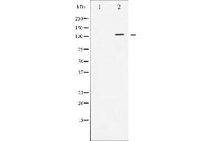 Western blot analysis of Androgen Receptor expression in LOVO whole cell lysates,The lane on the left is treated with the antigen-specific peptide. (Androgen Receptor anticorps)
