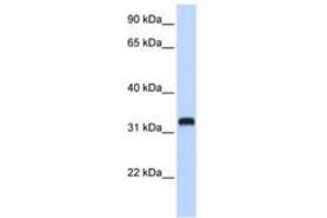 Image no. 1 for anti-Chromosome 21 Open Reading Frame 62 (C21orf62) (AA 108-157) antibody (ABIN6740939) (C21orf62 anticorps  (AA 108-157))