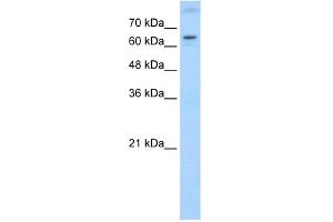 WB Suggested Anti-RORA Antibody Titration:  1. (RORA anticorps  (N-Term))