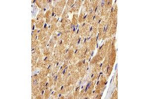Immunohistochemical analysis of paraffin-embedded M. (FABP3 anticorps  (AA 1-133))
