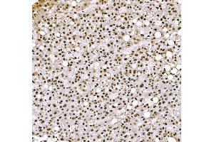 anti-H1 Histone Family, Member 0 (H1F0) (AA 20-159) antibody