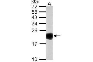 WB Image Sample (50 ug of whole cell lysate) A: mouse brain 15% SDS PAGE antibody diluted at 1:1000 (SOD1 anticorps)