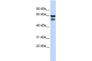 WB Suggested Anti-GALNT4 Antibody Titration:  0. (GALNT4 anticorps  (Middle Region))