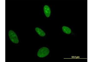 Immunofluorescence of monoclonal antibody to UMPS on HeLa cell. (UMPS anticorps  (AA 381-479))