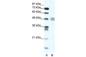 WB Suggested Anti-TRIP13  Antibody Titration: 5. (TRIP13 anticorps  (N-Term))