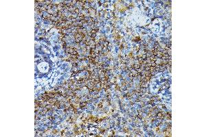Immunohistochemistry of paraffin-embedded mouse spleen using G Rabbit pAb (ABIN6129931, ABIN6137010, ABIN6137011 and ABIN6217659) at dilution of 1:100 (40x lens).
