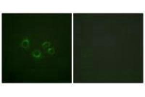 Immunofluorescence analysis of A549 cells, using EPHA2/3/4 (Ab-588/596) antibody. (EPH Receptor A2 anticorps  (Tyr588, Tyr596))