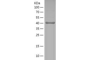 Western Blotting (WB) image for Discs, Large Homolog 4 (Drosophila) (DLG4) (AA 9-121) protein (His-IF2DI Tag) (ABIN7122678)