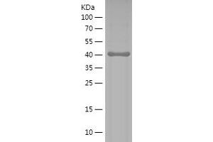 Western Blotting (WB) image for Discs, Large Homolog 4 (Drosophila) (DLG4) (AA 9-121) protein (His-IF2DI Tag) (ABIN7282746) (DLG4 Protein (AA 9-121) (His-IF2DI Tag))