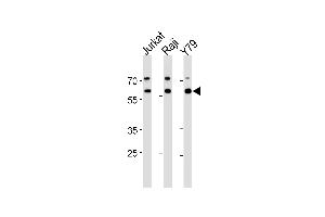 ACHE Antibody (N-term) (ABIN392325 and ABIN2841973) western blot analysis in Jurkat,Raji,Y79 cell line lysates (35 μg/lane). (Acetylcholinesterase anticorps  (N-Term))