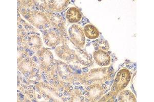 Immunohistochemistry of paraffin-embedded Rat kidney using PIP4K2A Polyclonal Antibody at dilution of 1:100 (40x lens).