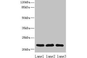 Western blot All lanes: SSR3 antibody at 10 μg/mL Lane 1: Hela whole cell lysate Lane 2: U87 whole cell lysate Lane 3: A431 whole cell lysate Secondary Goat polyclonal to rabbit IgG at 1/10000 dilution Predicted band size: 22, 23 kDa Observed band size: 22 kDa (SSR3 anticorps  (AA 77-135))
