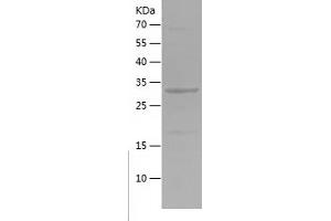 Western Blotting (WB) image for Nitric Oxide Synthase 1, Neuronal (NOS1) (AA 101-301) protein (His tag) (ABIN7124177)