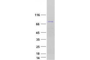 Validation with Western Blot