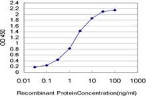 anti-Structural Maintenance of Chromosomes 1A (SMC1A) (AA 366-465) antibody