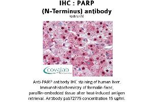 Image no. 1 for anti-Poly (ADP-Ribose) Polymerase 1 (PARP1) (N-Term) antibody (ABIN2852390)