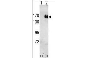 Western blot analysis of HER2(arrow) using rabbit polyclonal HER2 antibody. (ErbB2/Her2 anticorps)