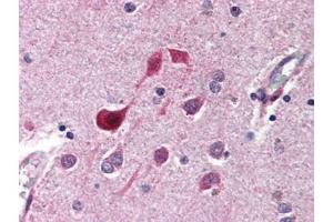 anti-CDK5 antibody  was diluted 1:500 to detect CDK5 in human brain cortex tissue. (CDK5 anticorps)