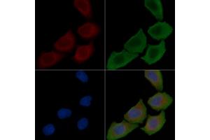 ABIN6257628 and ABIN6274171 staining Hela cells(30 min of UV treatment) by IF/ICC. (PRKCSH anticorps  (Internal Region))