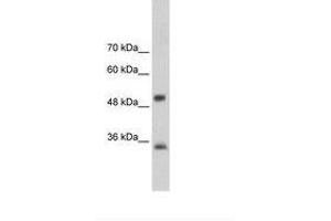 Image no. 2 for anti-Aryl Hydrocarbon Receptor Interacting Protein (AIP) (AA 101-150) antibody (ABIN202262) (AIP anticorps  (AA 101-150))