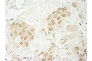 anti-Makorin Ring Finger Protein 1 (MKRN1) (C-Term) antibody