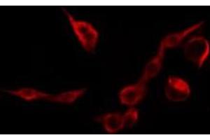 ABIN6269090 staining HepG2 by IF/ICC. (Integrin beta 3 anticorps  (C-Term))