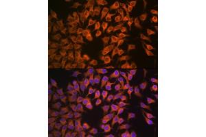 Immunofluorescence analysis of HeLa cells using CYP17 Rabbit mAb (ABIN7266648) at dilution of 1:100 (40x lens). (CYP17A1 anticorps)
