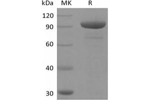 Western Blotting (WB) image for 5'-Nucleotidase, Ecto (CD73) (NT5E) (Active) protein (Fc Tag) (ABIN7319798)