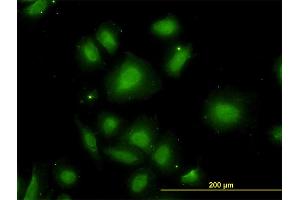Immunofluorescence of monoclonal antibody to CDR2 on HeLa cell. (CDR2 anticorps  (AA 296-404))