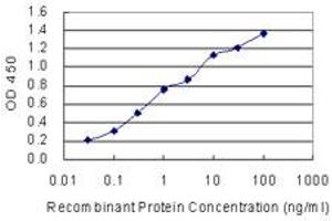 anti-Synovial Sarcoma, X Breakpoint 1 (SSX1) (AA 89-188) antibody