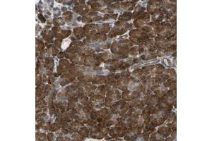 Immunohistochemical staining of human pancreas with CLCC1 polyclonal antibody  shows strong cytoplasmic positivity in exocrine glandular cells at 1:200-1:500 dilution. (CLCC1 anticorps)
