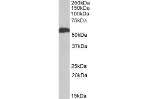 ABIN2561038 (1µg/ml) staining of Human Liver lysate (35µg protein in RIPA buffer). (ALDH5A1 anticorps  (AA 301-312))