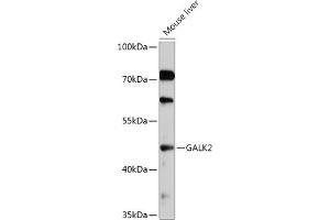 Western blot analysis of extracts of Mouse liver, using G antibody (ABIN7267329) at 1:1000 dilution. (GALK2 anticorps  (AA 109-458))