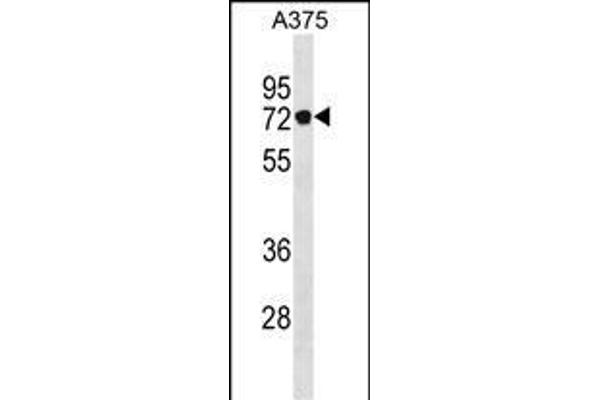 Podocan Antikörper  (C-Term)