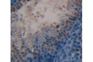 Used in DAB staining on fromalin fixed paraffin- embedded testis tissue (HSD17B3 anticorps  (AA 1-310))