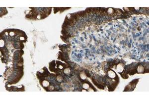 ABIN6269135 at 1/100 staining Mouse intestine tissue by IHC-P.