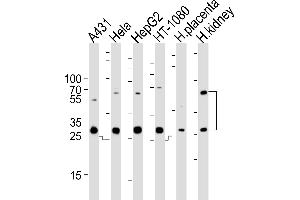 Western blot analysis of lysates from A431, Hela, HepG2, HT-1080 cell line and human placenta, kidney tissue lysate (from left to right), using CTSA Antibody (N-term) (ABIN654433 and ABIN2844169). (CTSA anticorps  (N-Term))