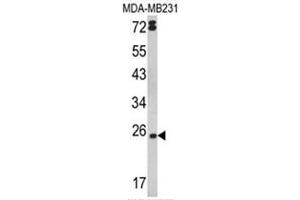 Western blot analysis of LTA Antibody (Center) in MDA-MB231 cell line lysates (35ug/lane). (LTA anticorps  (Middle Region))
