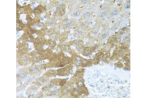 Immunohistochemistry of paraffin-embedded Mouse liver using BCL2L2 Polyclonal Antibody at dilution of 1:100 (40x lens). (BCL2L2 anticorps)