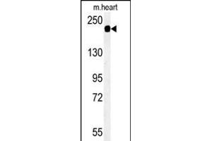 Western blot analysis of SD9L Antibody (C-term) (ABIN651359 and ABIN2840201) in mouse heart tissue lysates (35 μg/lane). (SAMD9L anticorps  (C-Term))