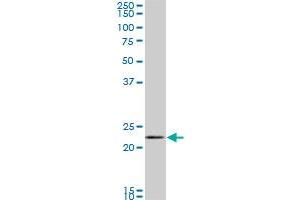 RAB11A monoclonal antibody (M01), clone 1F7-2A8.