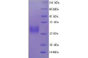 SDS-PAGE (SDS) image for Green Fluorescent Protein (GFP) (AA 1-238), (full length) protein (His tag) (ABIN5714102) (GFP Protein (AA 1-238, full length) (His tag))