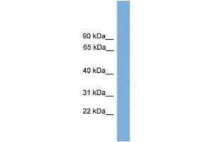 WB Suggested Anti-POLR3C  Antibody Titration: 0. (POLR3C anticorps  (Middle Region))