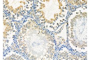 ABIN6263399 and ABIN6277160 at 1/100 staining Rat testis tissue by IHC-P. (Moesin anticorps  (C-Term))